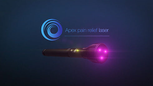 Apex Laser UK Ltd